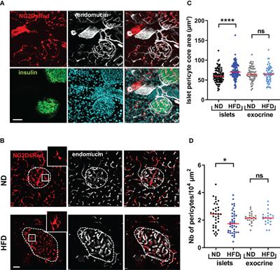 Metabolic Stress Impairs Pericyte Response to Optogenetic Stimulation in Pancreatic Islets